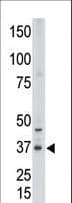 CDX2 Antibody (aa1-30)