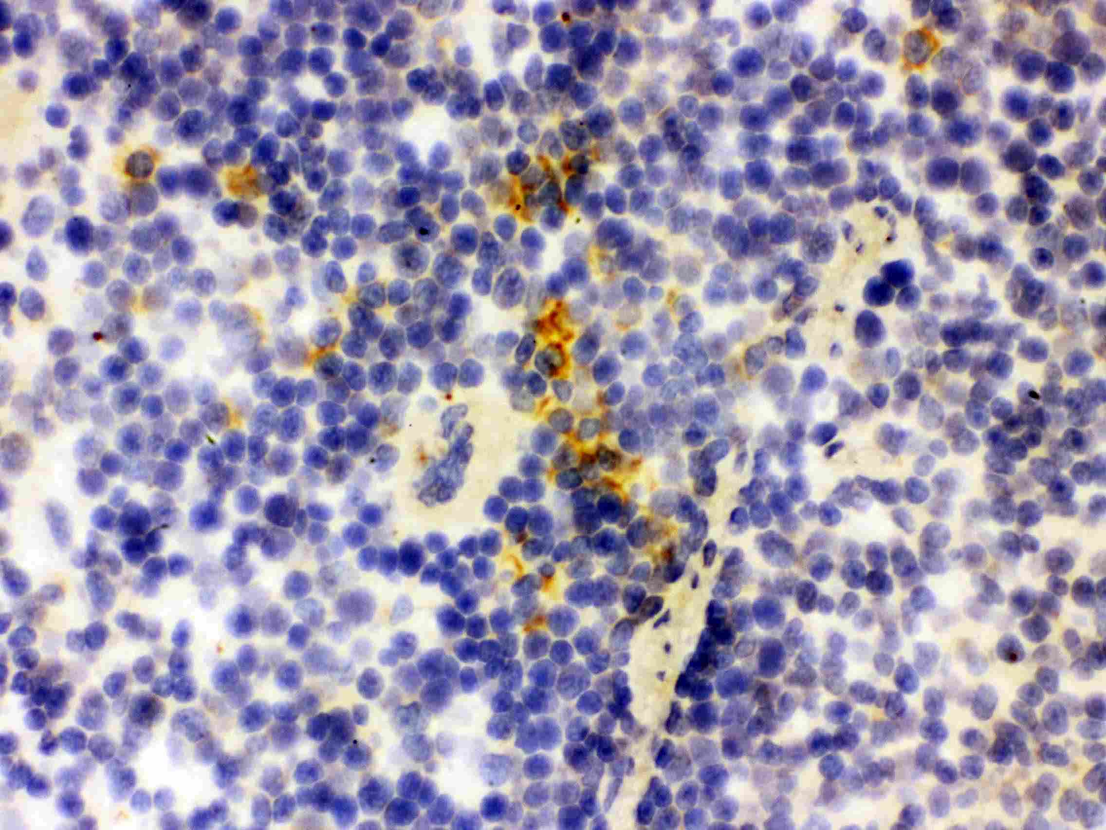 Polyclonal Rabbit anti-Rat LCN2 / Lipocalin 2 / NGAL Antibody (aa21-198, IHC, WB)