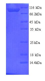 Rat MAPT / Tau Protein (Recombinant His)