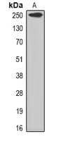 Polyclonal Rabbit anti-Human PDE4DIP / MMGL Antibody (IHC, WB)