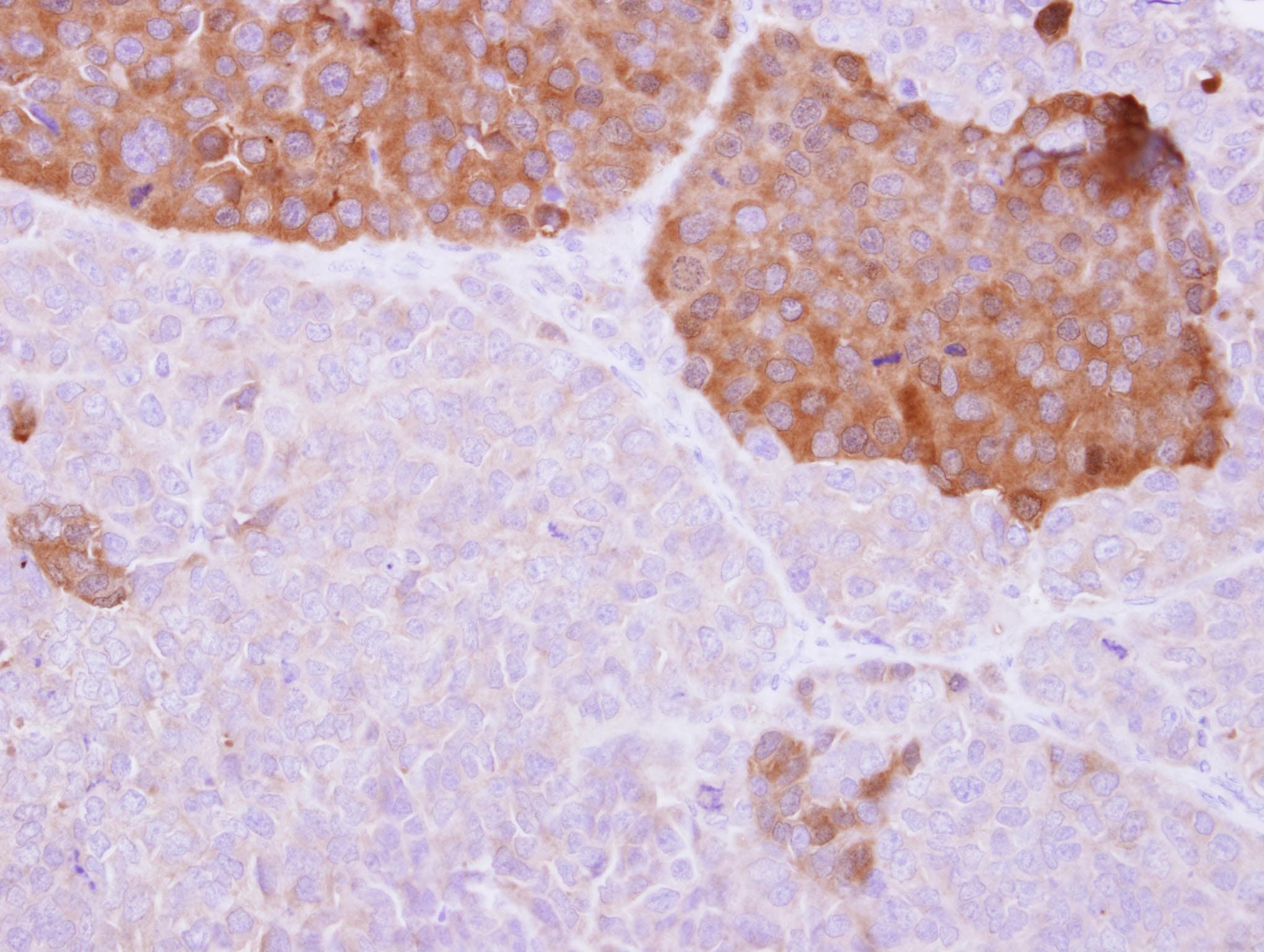 IL-22BP / IL22RA2 Antibody (aa1-218)
