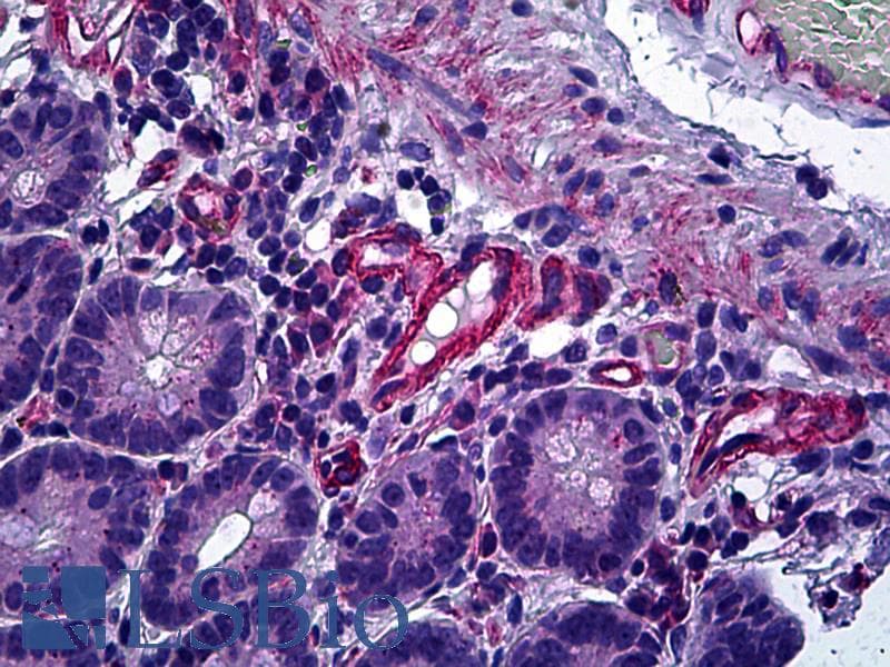 IHC-plus™ PPP3CA / CCN1 / Calcineurin A Antibody (aa21-51)