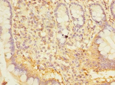 Polyclonal Rabbit anti-Human SNX6 Antibody (IHC, WB)