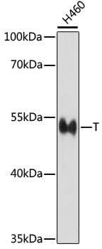 TBXT / T / Brachyury Antibody