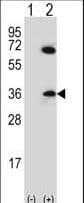 Polyclonal Rabbit anti-Human CDCA8 / Borealin Antibody (aa9-38, IHC, WB)