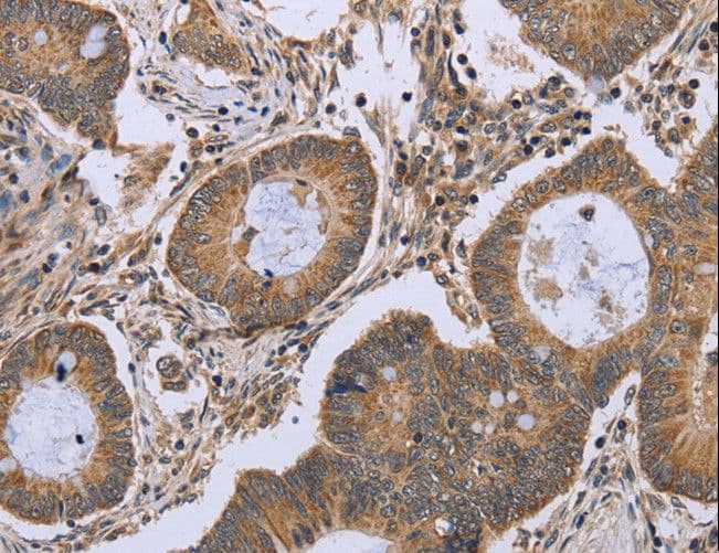 Polyclonal Rabbit anti-Human FKBP38 / FKBP8 Antibody (IHC, WB)
