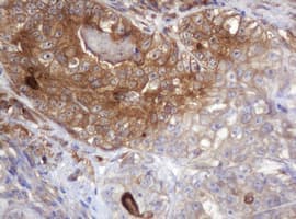 Monoclonal Mouse anti-Human ARPC5 / p16-Arc Antibody (clone 2G1, Carrier-free, IHC, WB)