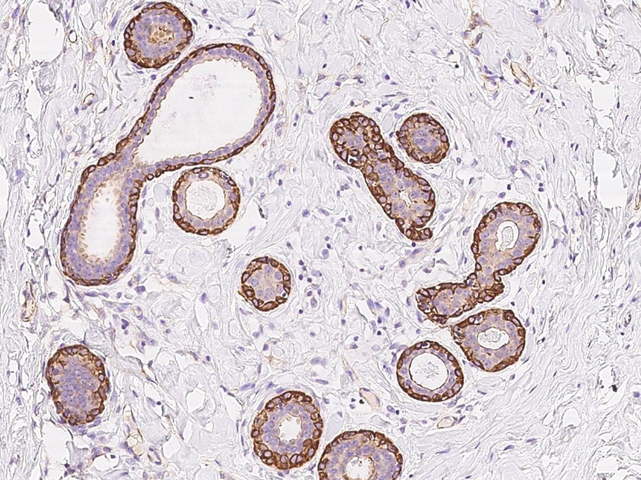 Polyclonal Rabbit anti-Human FAM124A Antibody (IHC)