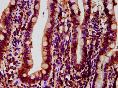 HYPE / FICD Antibody