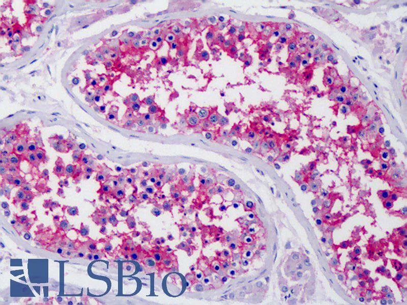 IHC-plus™ Basigin / Emmprin / CD147 Antibody (N-Terminus)