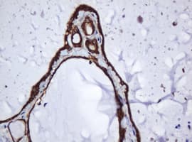 PAI-RBP1 / SERBP1 Antibody (aa1-262, clone OTI2C11)