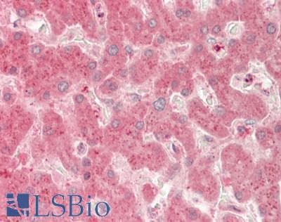 Polyclonal Rabbit anti-Human RELN / Reelin Antibody (aa26-190, IHC, WB)