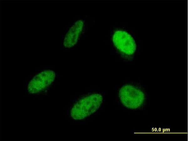 SRP68 Antibody (clone 3A3)