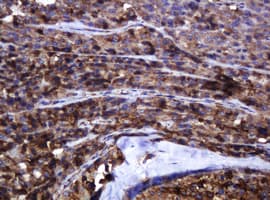 Monoclonal Mouse anti-Human POGK Antibody (clone OTI3E2, IHC, WB)