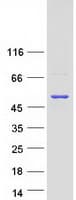 Human IPMK Protein (Recombinant Myc-DDK (Flag))