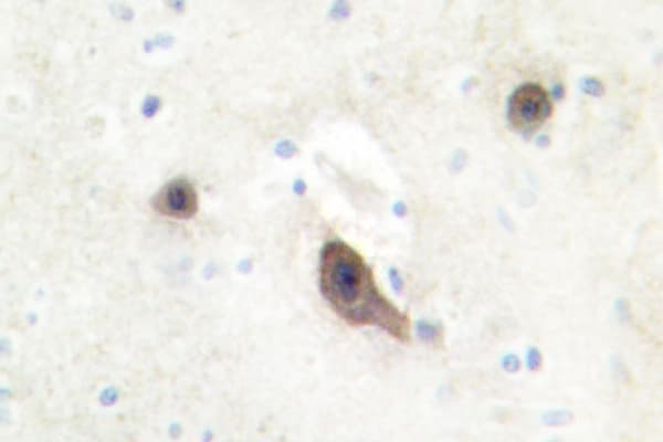 Polyclonal Rabbit anti-Human BRAF / B-Raf Antibody (Tyr198, IHC, IF, WB)