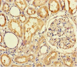 Polyclonal Rabbit anti-Human TMPRSS7 Antibody