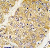 Polyclonal Rabbit anti-Mouse DTNBP1 / Dysbindin Antibody (aa296-325, IHC, WB)