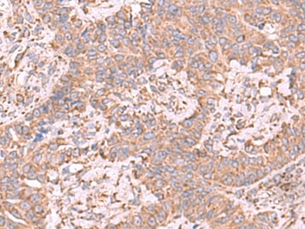 Polyclonal Rabbit anti-Human EEF1D Antibody (IHC, WB)