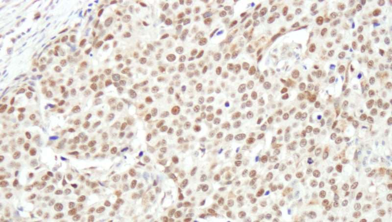 Polyclonal Rabbit anti-Human NUCKS1 Antibody (aa147-197, IHC)