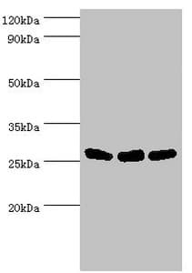 AK2 / Adenylate Kinase 2 Antibody (aa1-232)