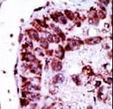 Polyclonal Rabbit anti-Human AK2 / Adenylate Kinase 2 Antibody (aa1-30, IHC, WB)