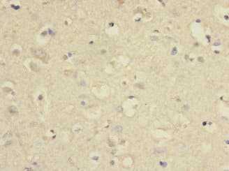 SLC2A13 / HMIT / GLUT13 Antibody