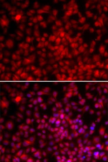 Polyclonal Rabbit anti-Human NF45 / ILF2 Antibody (IF, WB)