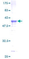 Human FMR1NB Protein (Recombinant GST)