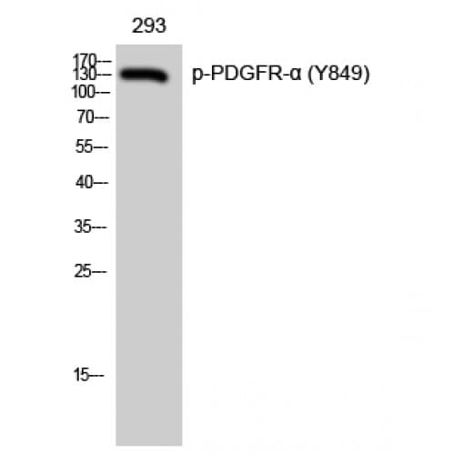 PDGFRA / PDGFR Alpha Antibody (790-870 aa)