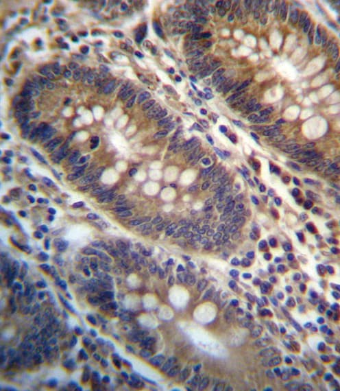 PGAP3 / PERLD1 Antibody (aa141-169)