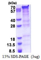 Human PRRT2 Protein (Recombinant His)