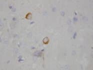 NOS1 / nNOS Antibody (aa1418-1434)