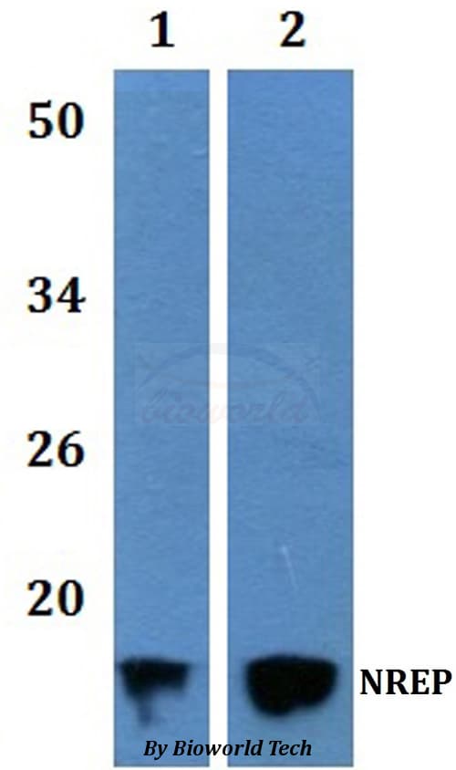 Polyclonal Rabbit anti-Human C5orf13 Antibody (WB)