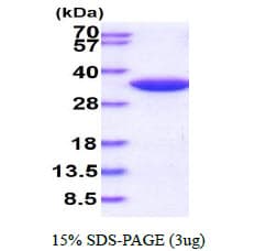 Human ISG15 Protein (Recombinant)