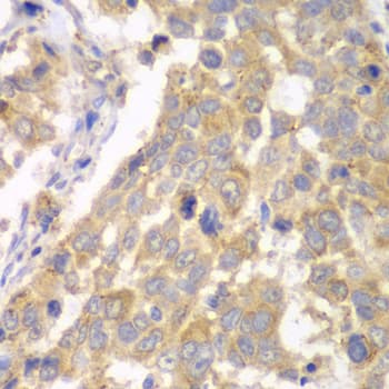 PFKM / PFK-1 Antibody
