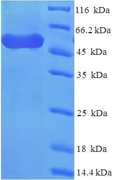 Human WDR77 / MEP50 Protein (Recombinant His-SUMO)