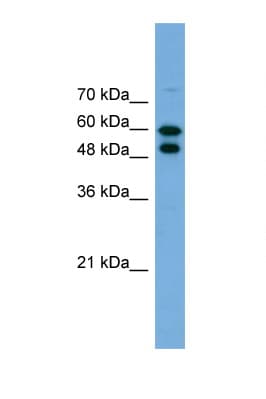 PGM1 / Phosphoglucomutase 1 Antibody (aa467-516)