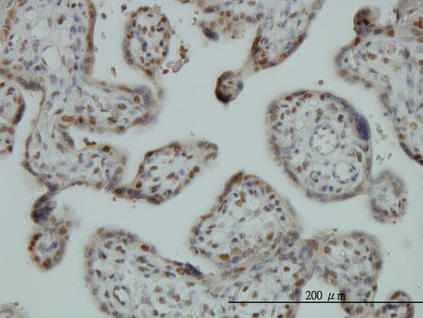 FUBP1 Antibody (clone 3H4)