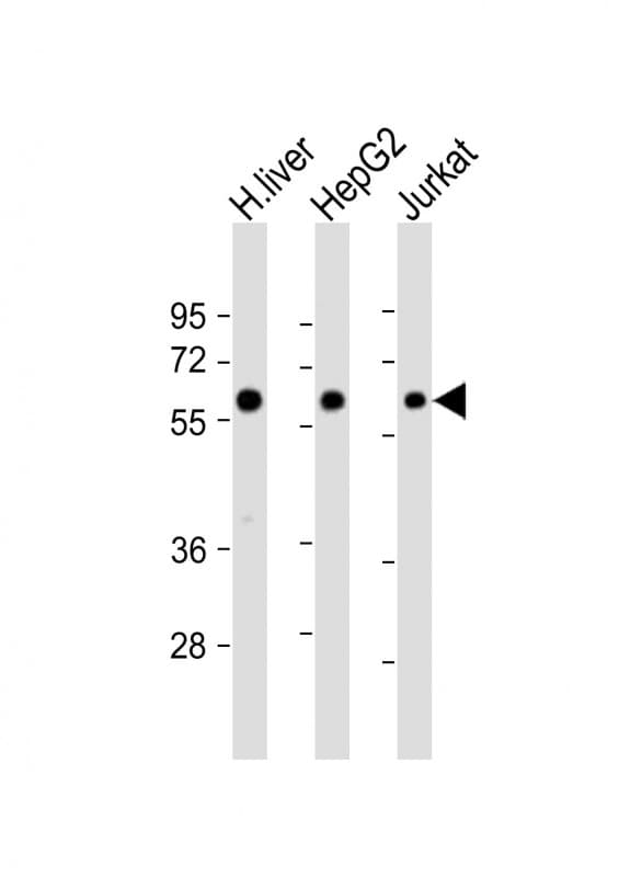 CYP2E1 Antibody (aa166-198)