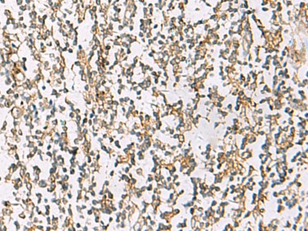 Polyclonal Rabbit anti-Human ZPBP2 Antibody (IHC)