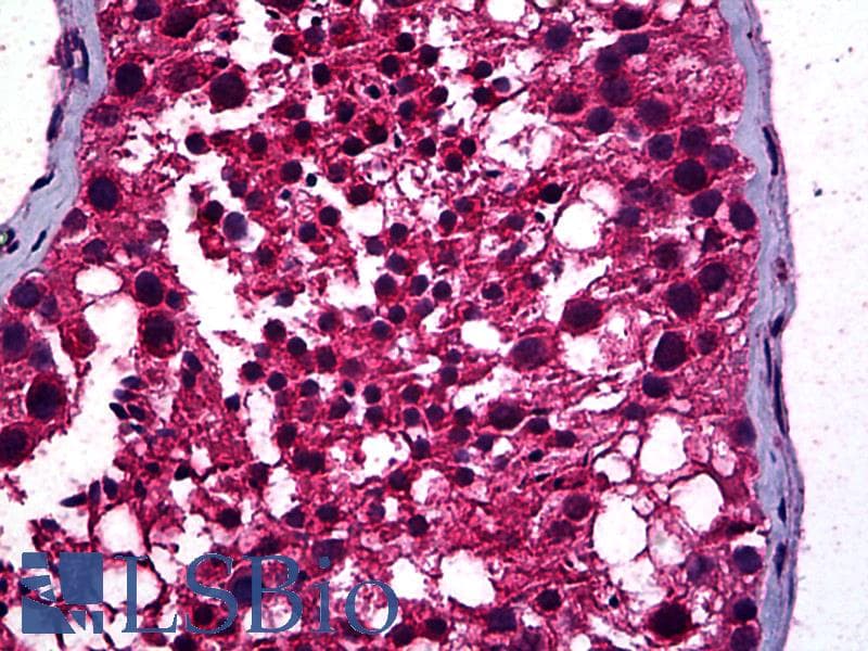 IHC-plus™ Monoclonal Mouse anti-Human STAT4 Antibody (clone 1C2-1C12, IHC, IF, WB)