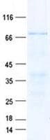 Human NR1D1 Protein (Recombinant His, N-Terminal)
