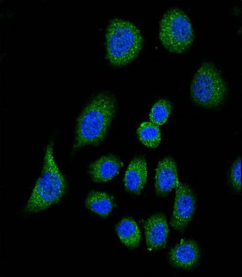 Polyclonal Rabbit anti-Human CFH / Complement Factor H Antibody (aa751-780, IHC, IF, WB)