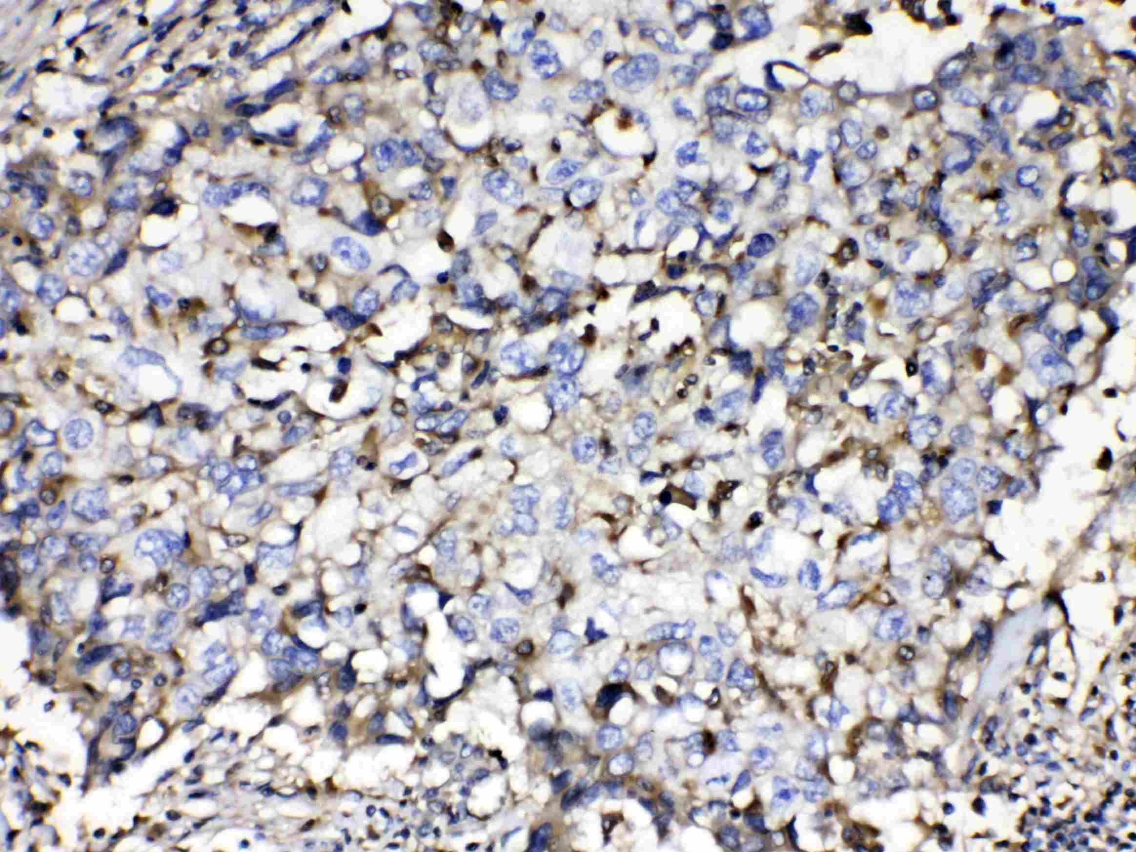 Polyclonal Rabbit anti-Human B2M / Beta 2 Microglobulin Antibody (IHC, WB)