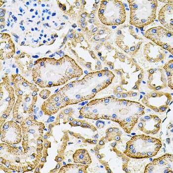 IHC-plus™ SLC4A4 / NBC1 Antibody