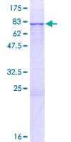 Human ERO1LB Protein (Recombinant GST)
