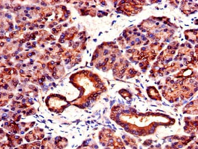 YWHAZ / 14-3-3 Zeta Antibody