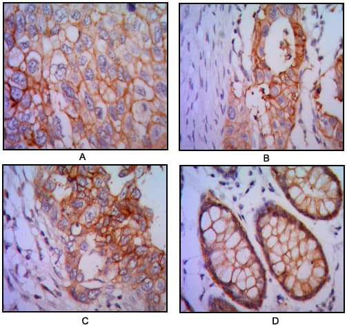 EPCAM Antibody (clone 7E+11)