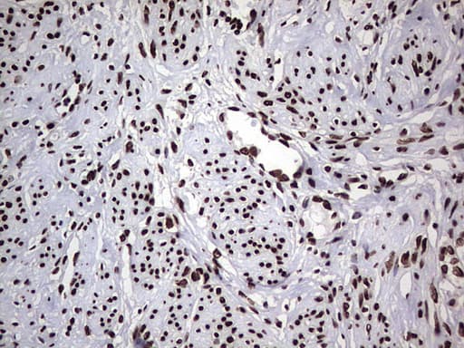 HNRNPL / hnRNP L Antibody (aa270-502, clone OTI9F11)